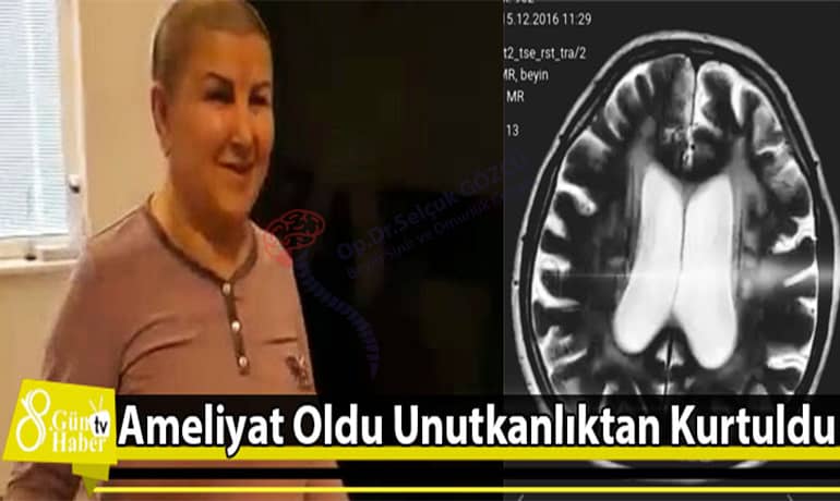 Ameliyat Oldu Unutkanlıktan Kurtuldu